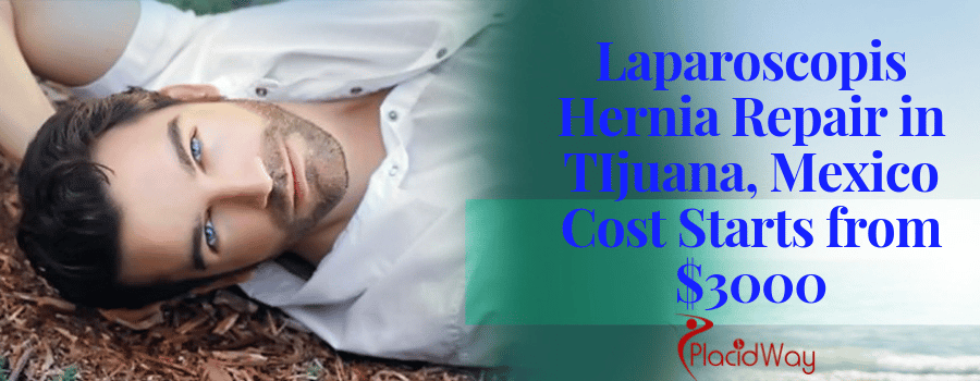 Laparoscopis Hernia Repair in TIjuana, Mexico Cost